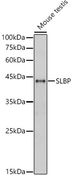 Anti-SLBP Antibody