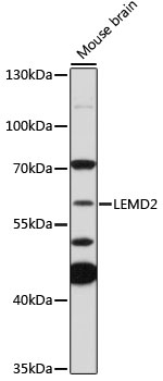 Anti-LEMD2 Antibody
