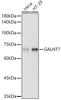 Anti-GALNT7 Antibody