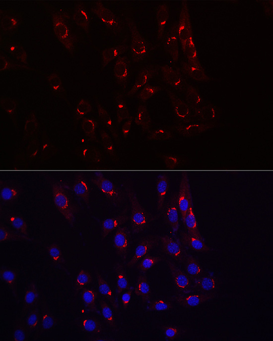 Anti-TJAP1 Antibody