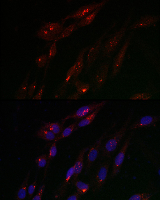 Anti-TJAP1 Antibody Anti-TJAP1 Antibody
