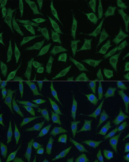 Anti-SUMF2 Antibody Anti-SUMF2 Antibody
