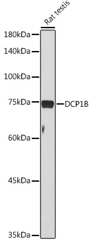 Anti-DCP1B Antibody