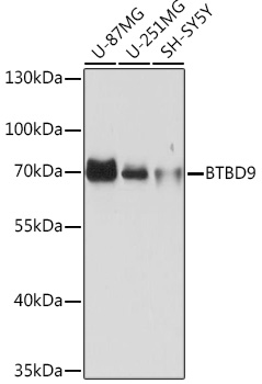 Anti-BTBD9 Antibody