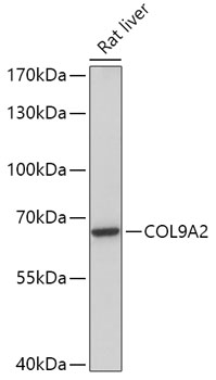 Anti-COL9A2 Antibody