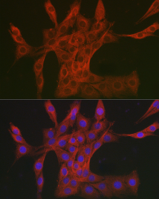 Anti-DAB2IP Antibody