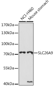Anti-SLC26A9 Antibody