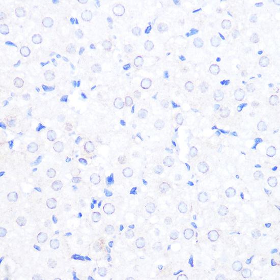 Anti-RanBP2 Antibody