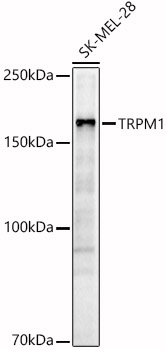 Anti-TRPM1 Antibody