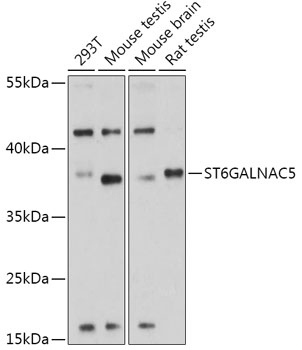 Anti-ST6GALNAC5 Antibody