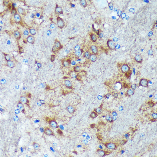 Anti-GRSF1 Antibody Anti-GRSF1 Antibody