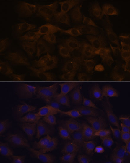 Anti-GRSF1 Antibody Anti-GRSF1 Antibody