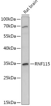 Anti-RNF115 Antibody