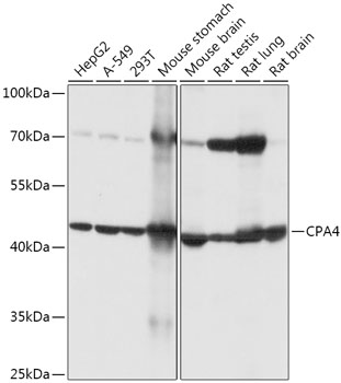 Anti-CPA4 Antibody