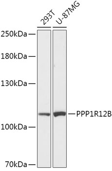 Anti-PPP1R12B Antibody