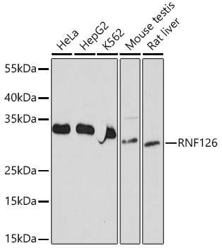 Anti-RNF126 Antibody