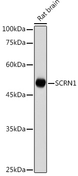 Anti-SCRN1 Antibody