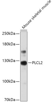 Anti-PLCL2 Antibody