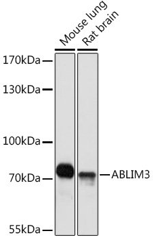 Anti-ABLIM3 Antibody