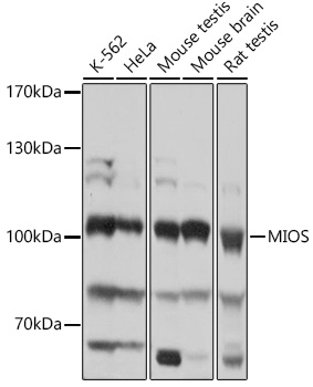 Anti-MIOS Antibody