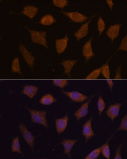 Anti-FBXW8 Antibody Anti-FBXW8 Antibody