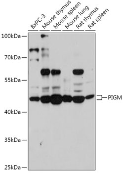 Anti-PIGM Antibody