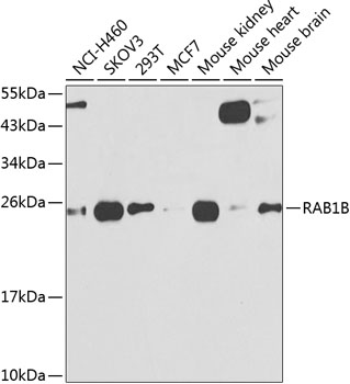 Anti-RAB1B Antibody