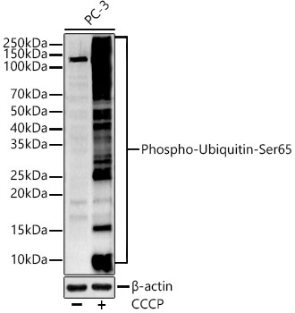 Anti-Ubiquitin (phospho Ser65) Antibody