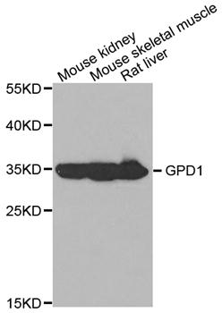 Anti-GPD1 Antibody