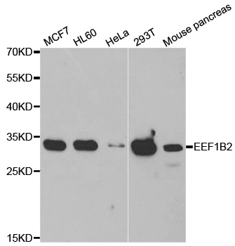 Anti-EEF1B2 Antibody