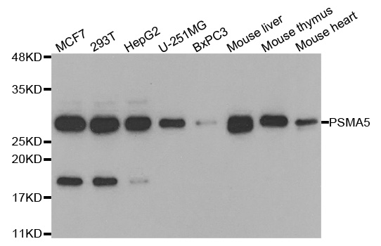 Anti-PSMA5 Antibody