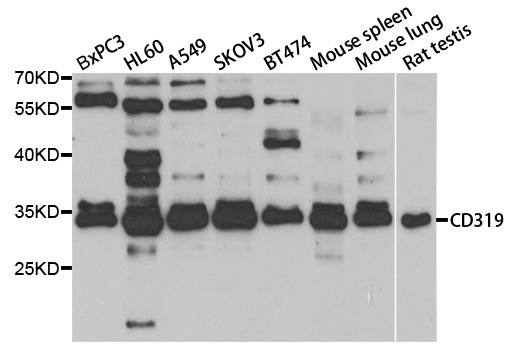 Anti-CD319 Antibody