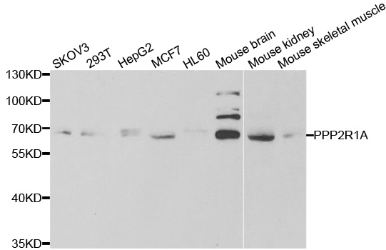 Anti-PPP2R1A Antibody