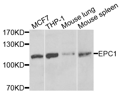 Anti-EPC1 Antibody