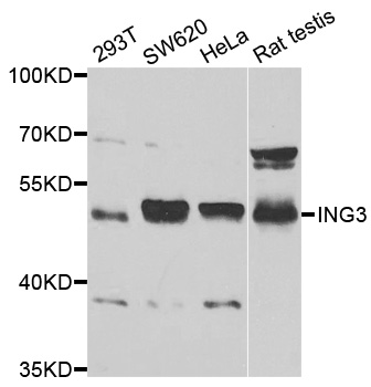 Anti-ING3 Antibody