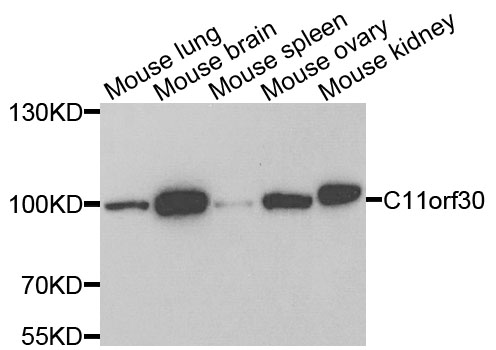 Anti-C11orf30 Antibody
