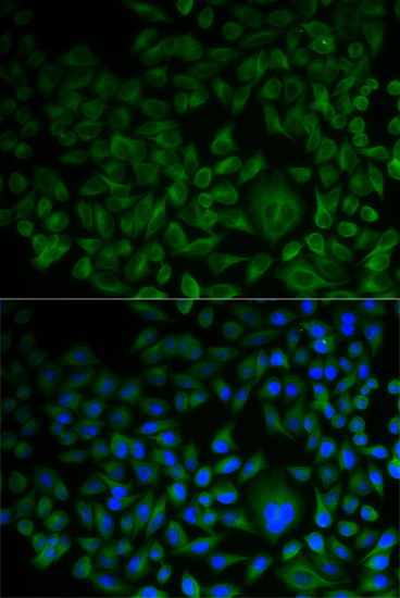 Anti-FDFT1 Antibody Anti-FDFT1 Antibody