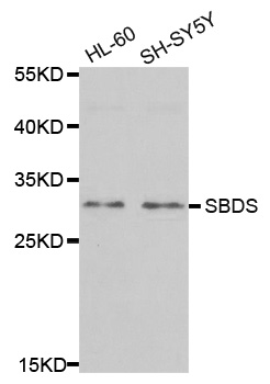 Anti-SBDS Antibody