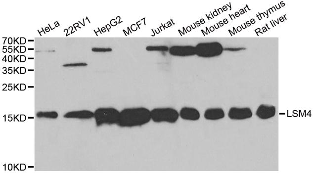 Anti-LSM4 Antibody