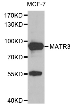 Anti-MATR3 Antibody