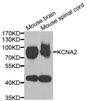 Anti-KCNA2 Antibody