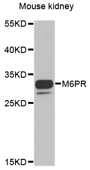 Anti-M6PR Antibody