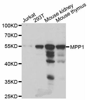 Anti-MPP1 Antibody