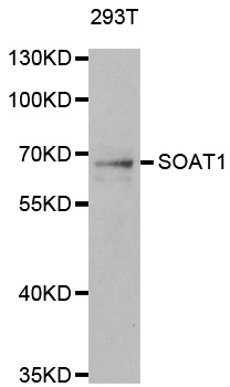 Anti-SOAT1 Antibody