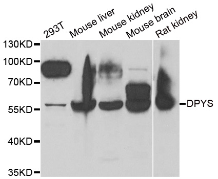 Anti-DPYS Antibody