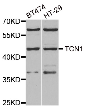 Anti-TCN1 Antibody