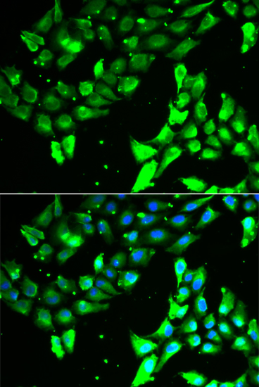 Anti-KIF2B Antibody Anti-KIF2B Antibody