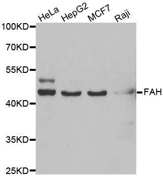 Anti-FAH Antibody Anti-FAH Antibody