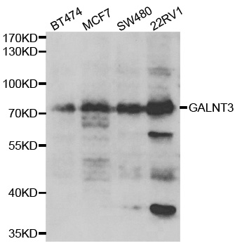 Anti-GALNT3 Antibody