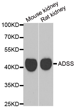 Anti-GATM Antibody